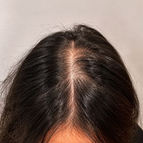 قبل استخدام زيت جيرا